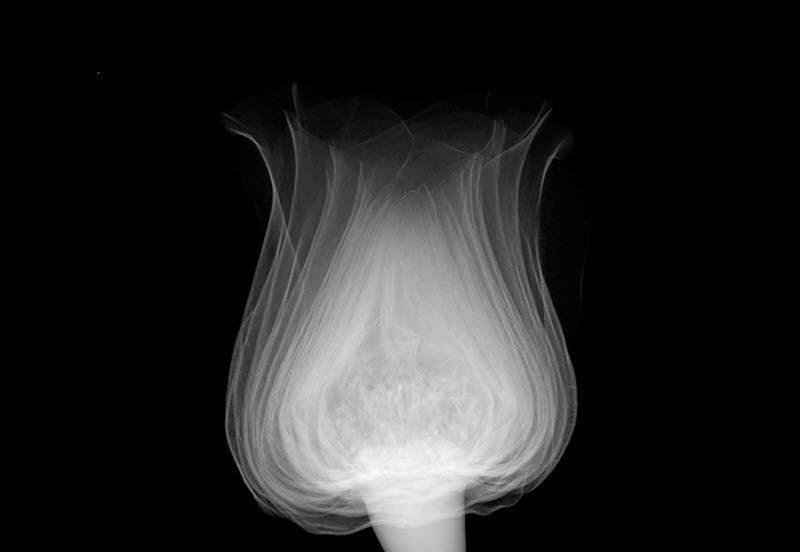 xray art tulip